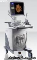 Цветной Узи сканер SonoScape SSI-6000 | Стоимость, прайс-листы и цены в городе Киев